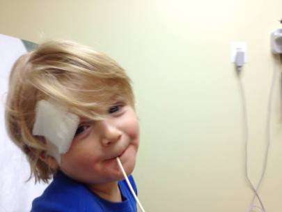 Raymond stitches